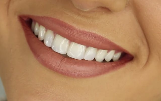 Teeth smile